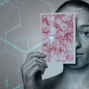 MIT Researchers Develop An AI Tool To Detect Skin Cancer